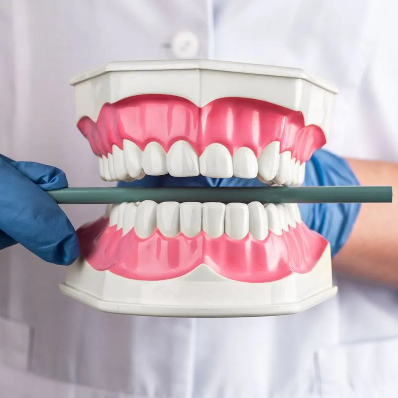 Tipos de maloclusiones dentales